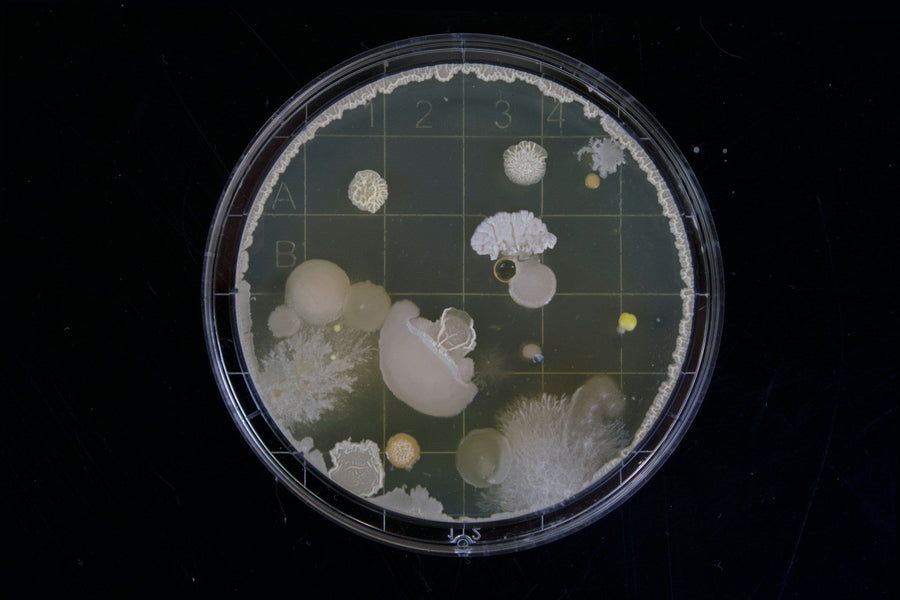 Helicobacter pylori (H. pylori) bakterija